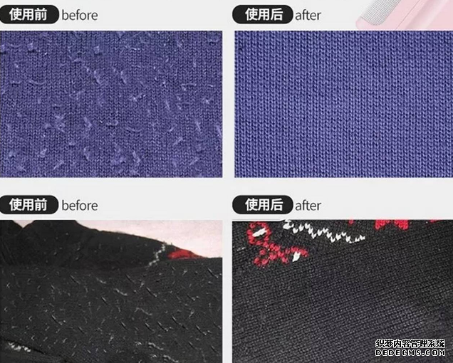 毛衣起球了怎么辦 毛衣應該怎么保養(yǎng) 毛衣起球了怎么辦 毛衣應該怎么保養(yǎng)