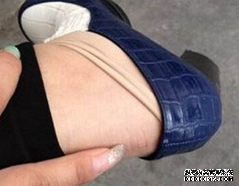 新鞋磨腳跟怎么辦 新鞋磨腳跟的處理方法 新鞋磨腳跟怎么辦 新鞋磨腳跟的處理方法